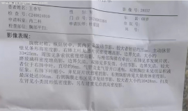 6次化疗后继续治疗方案怎么选？